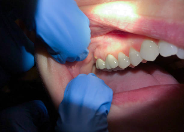 Best Knocked-Out Tooth Emergency  in Monongahela, PA
